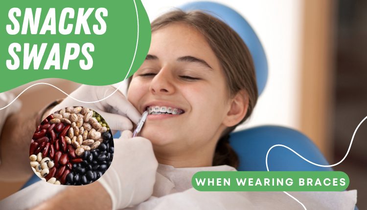Snack Swaps To Make When Wearing Braces